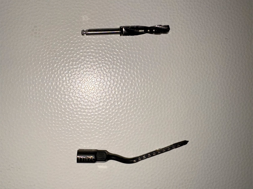 Confronto tra fresa tradizionale e punta ad ultrasuoni per foro implantare nell’implantologia computer guidata