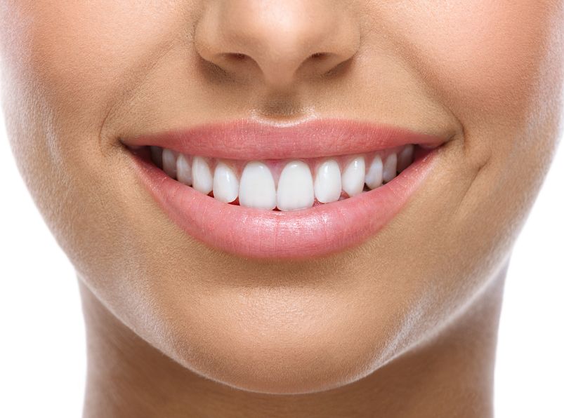 Sorriso naturale dopo trattamento di odontoiatria estetica digitale