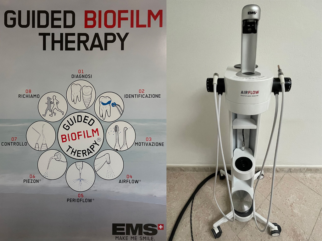 Guided Biofilm Therapy per il trattamento parodontale Trattamento parodontale con Guided Biofilm Therapy a Olbia